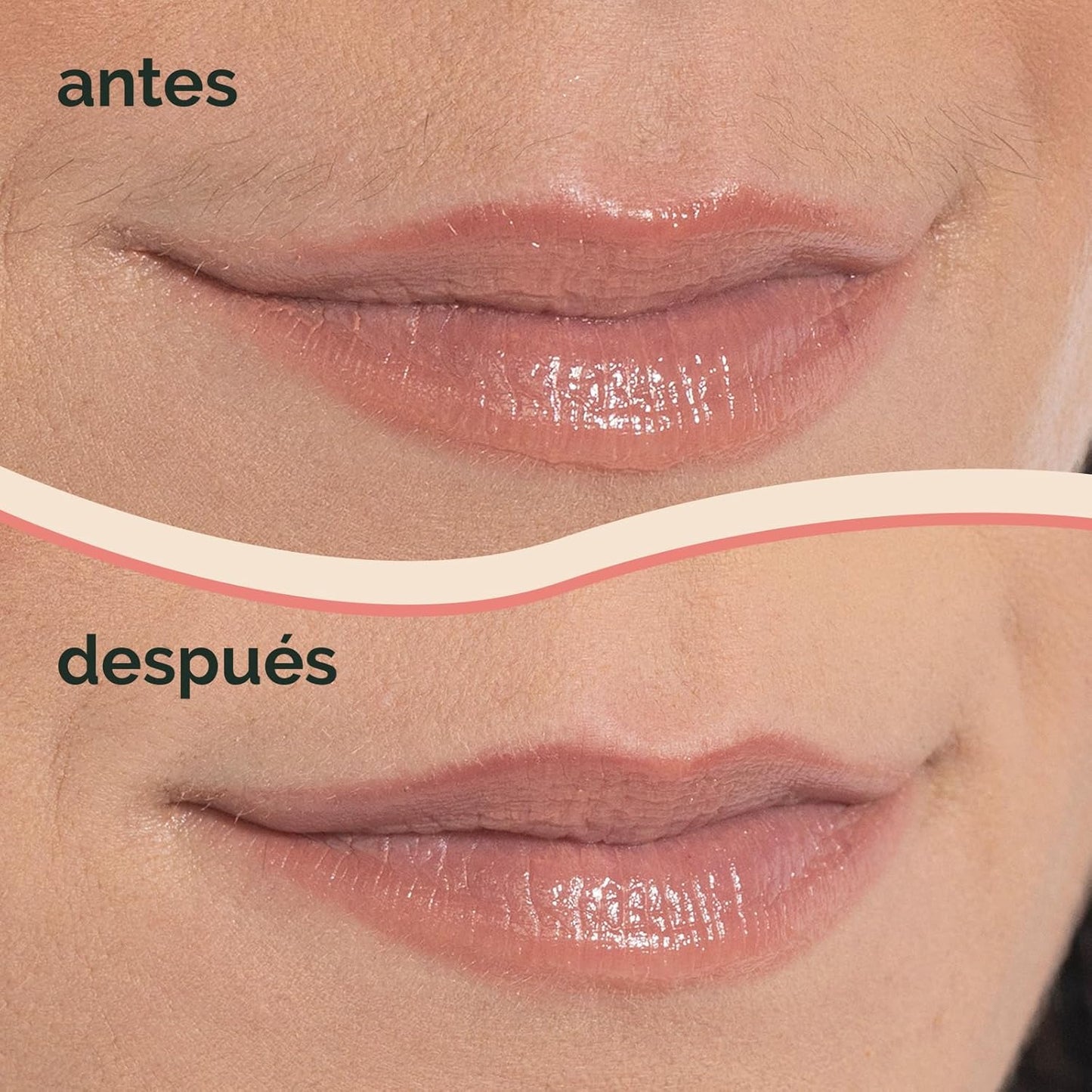 FACIAL PRO ALEGRE®